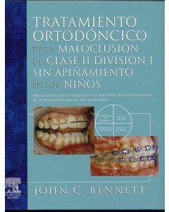 Tratamiento Ortodoncico De La Maloclusion Claseii