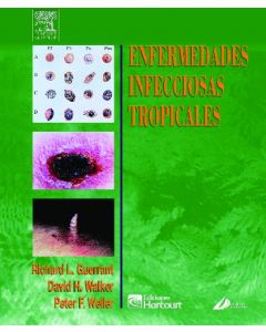Enfermedades infecciosas tropicales