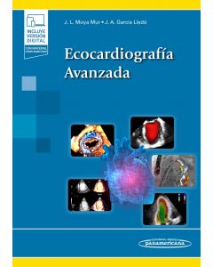 Ecocardiografía Avanzada