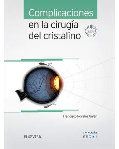 Complicaciones En La Cirugía Del Cristalino (Monografías Secoir)