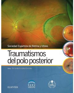 Traumatismos Del Polo Posterior + Acceso Online