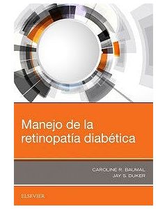 Manejo De La Retinopatía Diabética