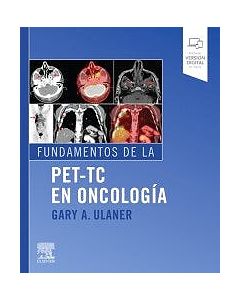 Fundamentos De La Pet-Tc En Oncología
