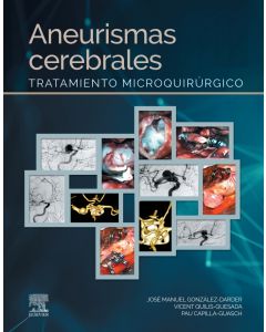 Aneurismas Cerebrales