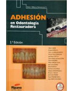 Adhesion En Odontologia Restauradora