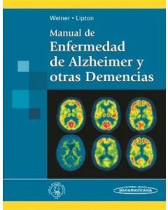 Manual De Enfermedad De Alzheimer Y Otras Demencias