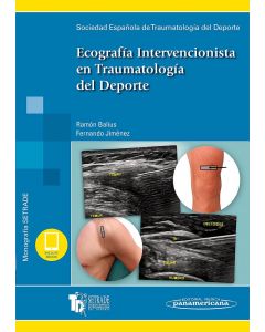 Ecografía Intervencionista En Traumatología Del Deporte (Monografías Setrade)