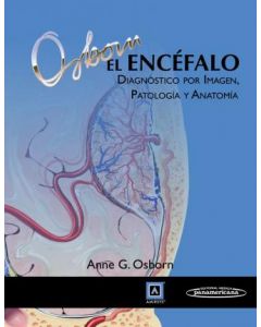 El Encéfalo Diagnóstico Por Imagen Patología Y Anatomía