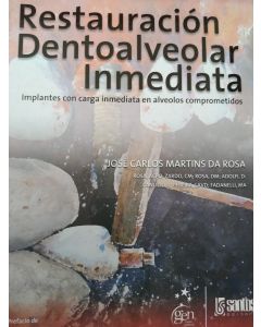 Restauración Dentoalveolar Inmediata