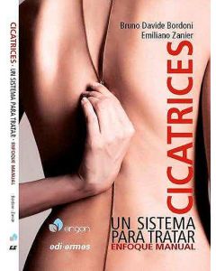 Cicatrices. Un Sistema Para Tratar. Enfoque Manual