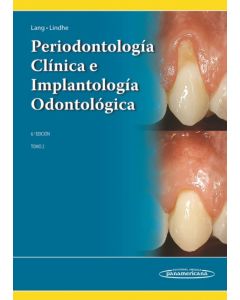 Periodontología Clínica E Implantología Odontológica, Tomo 2