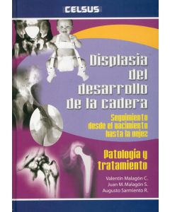 Displasia Del Desarrollo De La Cadera