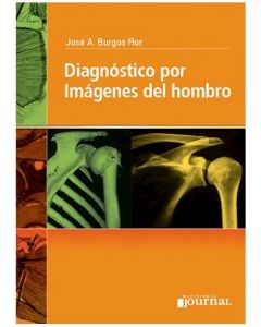 Diagnóstico Por Imágenes Del Hombro