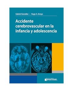 Accidente Cerebrovascular En La Infancia Y Adolescencia