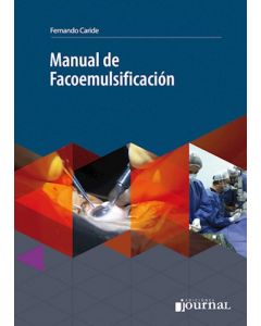Manual De Facoemulsificación