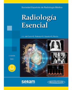Radiología Esencial